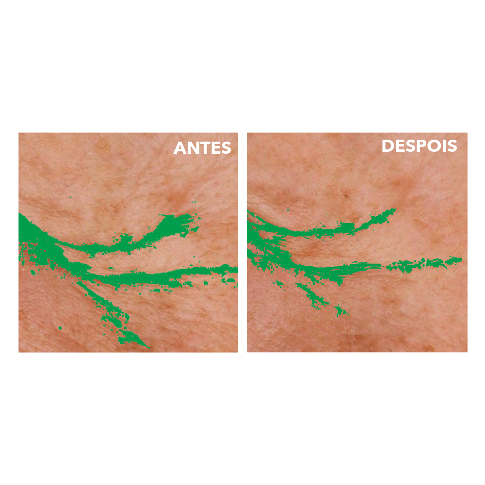 Creme de Olhos Antirrugas & Antipapos | Yves Rocher Portugal 